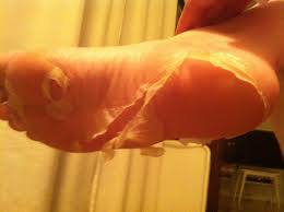 Peeling hele voet2